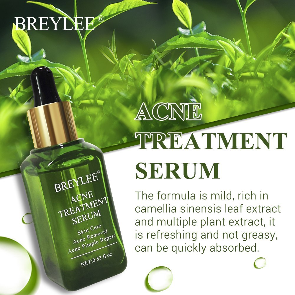 ✨ BREYLEE Acne Treatment Serum ✨